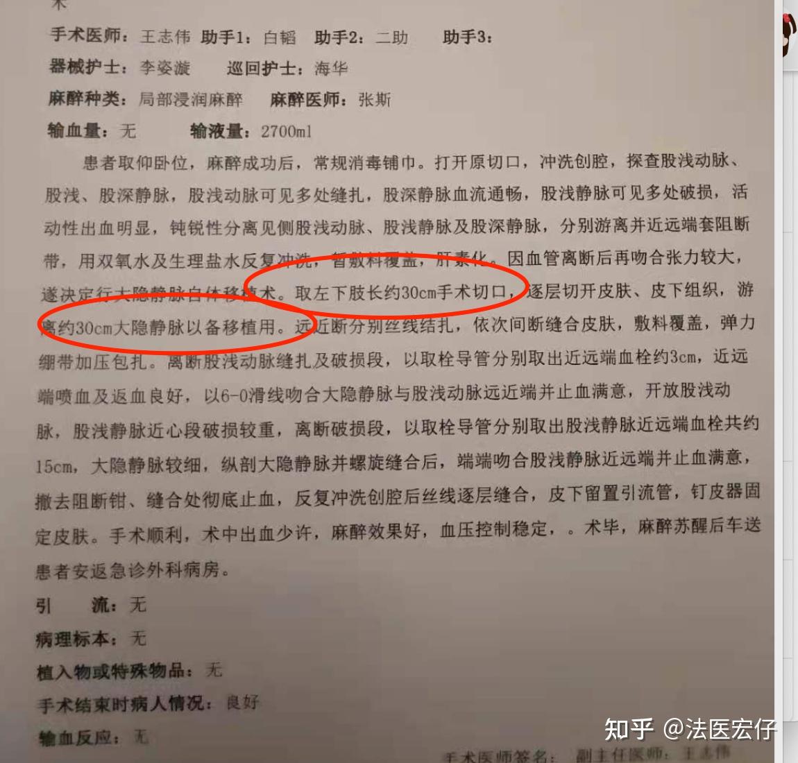 重伤二级鉴定为轻微伤,长达3年的维权历程-维权经典案例分享 - 知乎