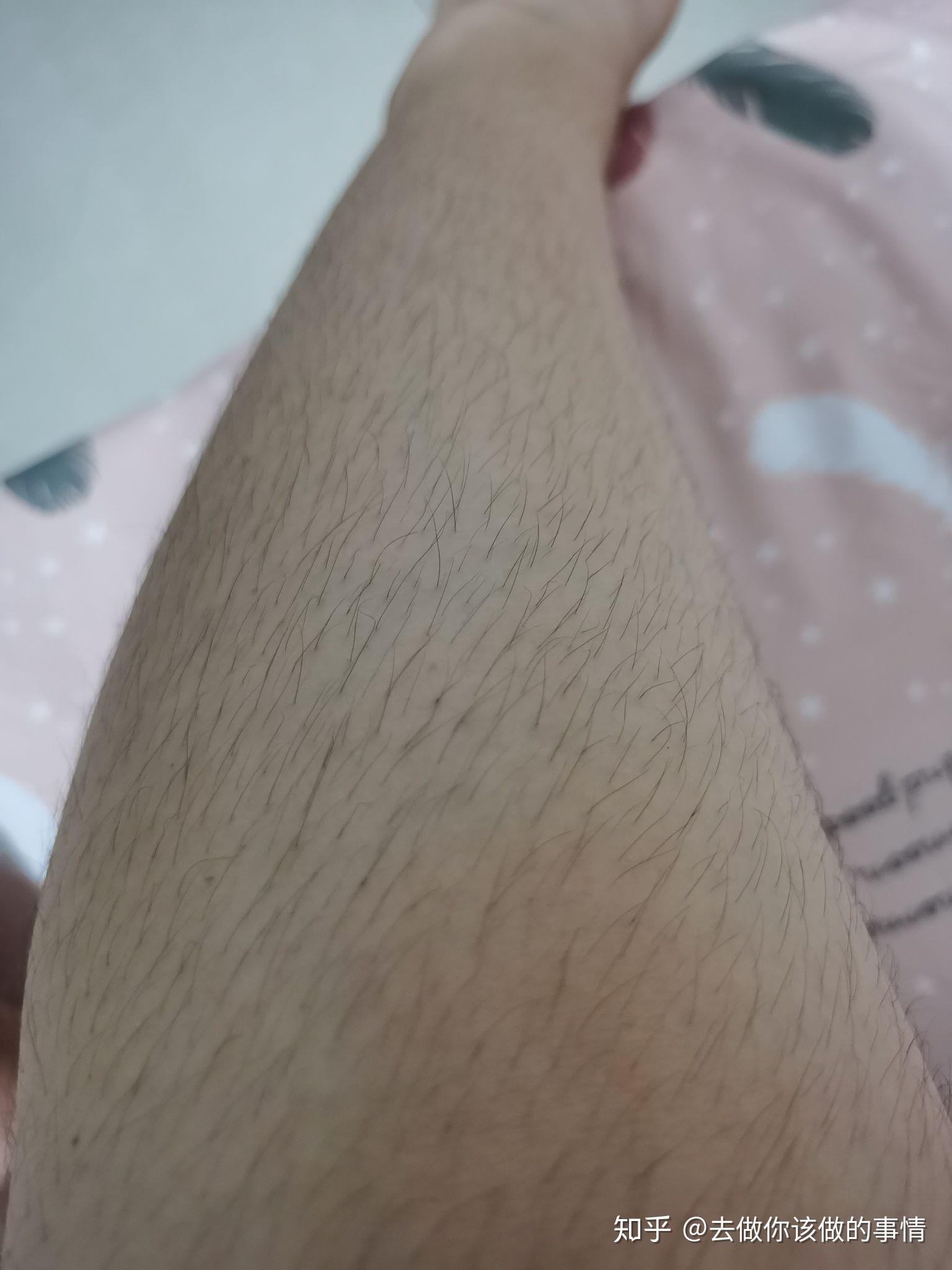 女生汗毛重是怎样的一种体验