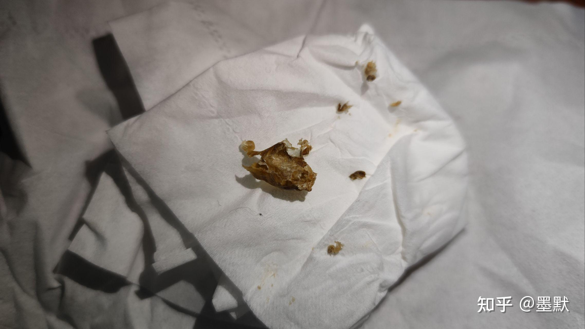 掏出一块超大耳屎是种什么体验