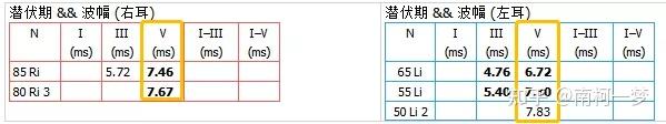 如何看懂电生理报告?(ABR篇) - 知乎