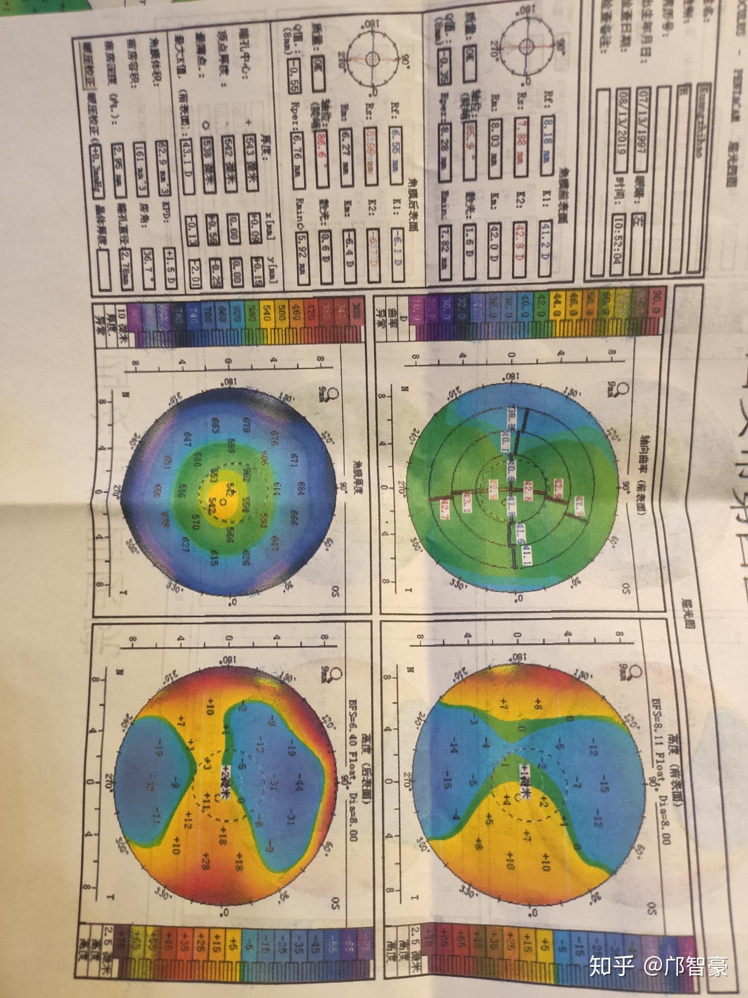 请大神看一下角膜地形图是不是不规则散光晚上看东西上下重影