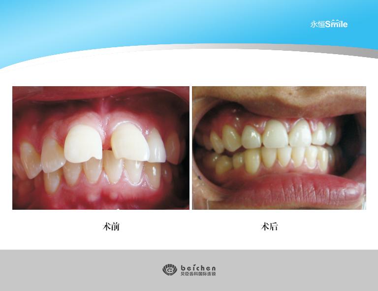 v2-05c6e73938ce40051d506cab91180332_1440w.jpg?source=172ae18b