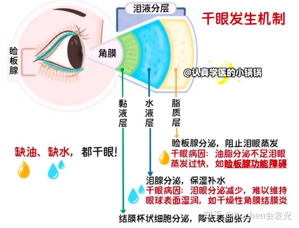 视疲劳和近视到底有什么关系？日常中我们该如何做好视力保护？ - 知乎
