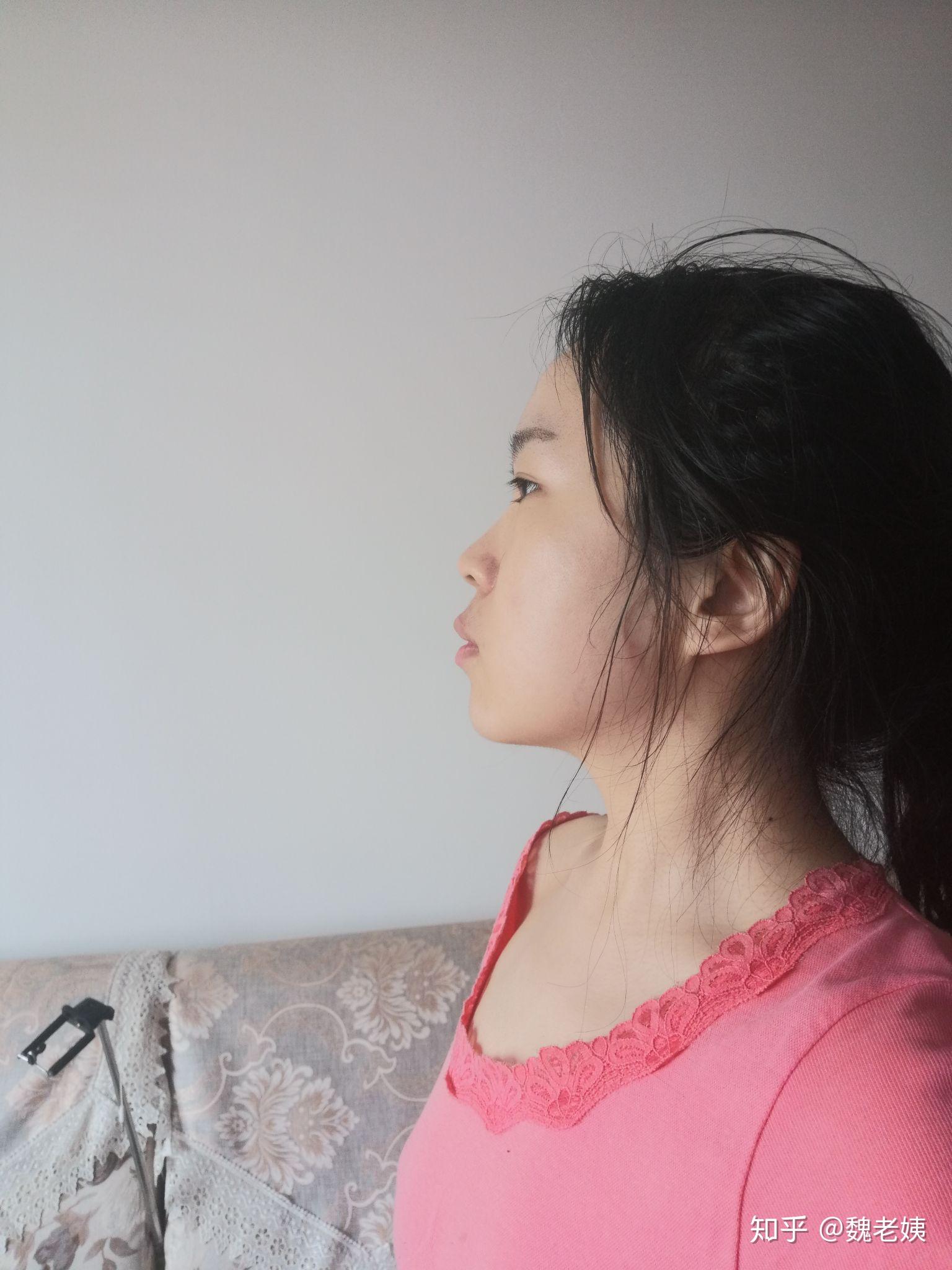 张嘴呼吸面容变丑能恢复吗?