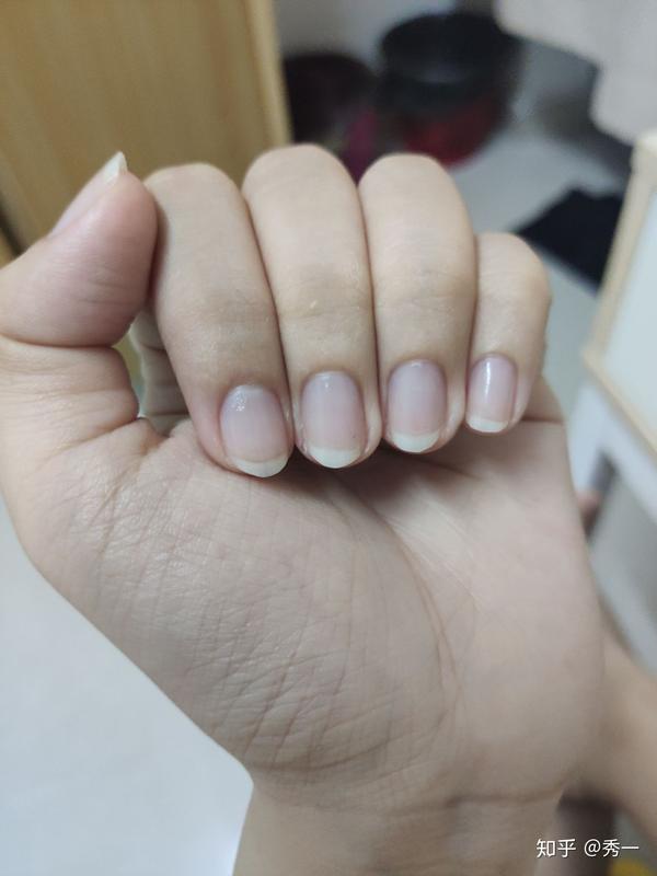 记录养指甲游离线的帖子 - 知乎