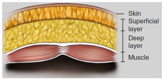 浅层与深层脂肪组织在人体分布的区别?了解抽脂手术的关键分层!
