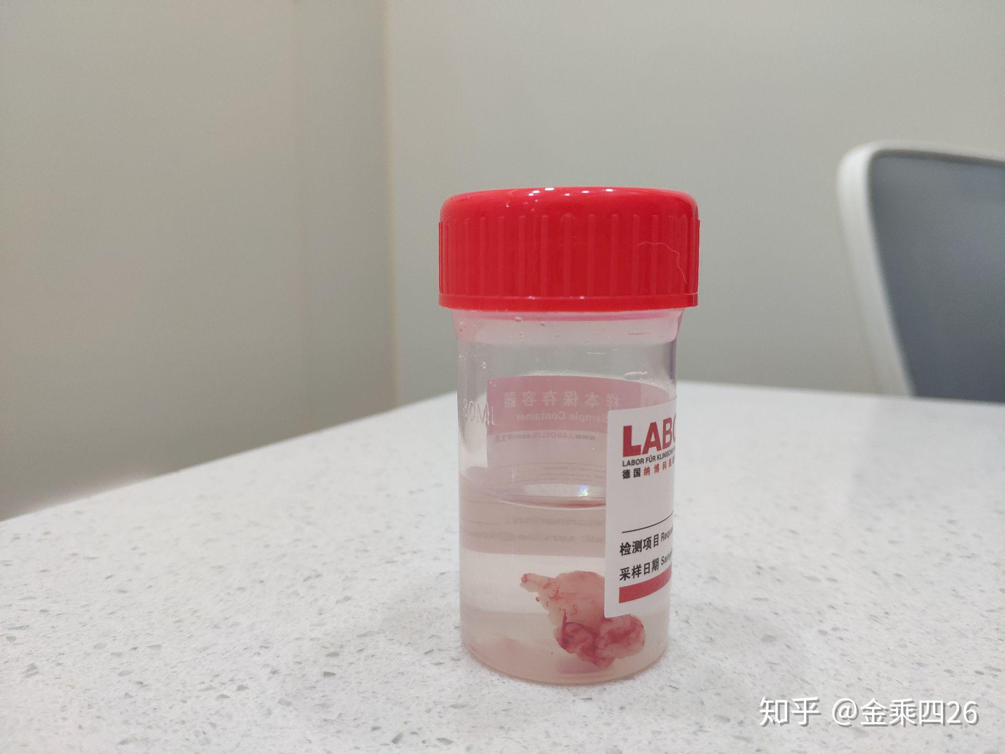 怎么看小猫是否有口炎 v2-05fff171b7f9397586520c7e6245abec_r.jpg