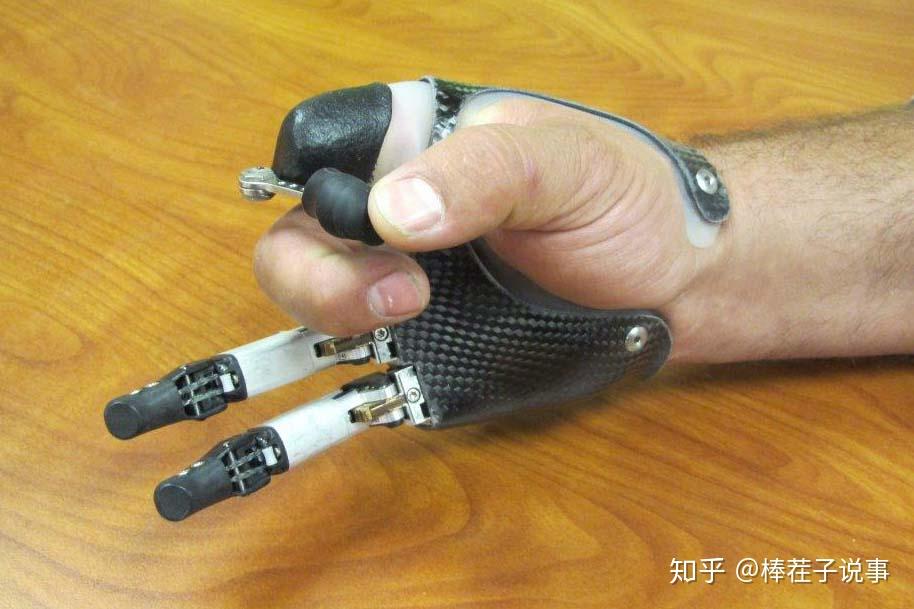 手指和部分手缺失的假肢安装方案