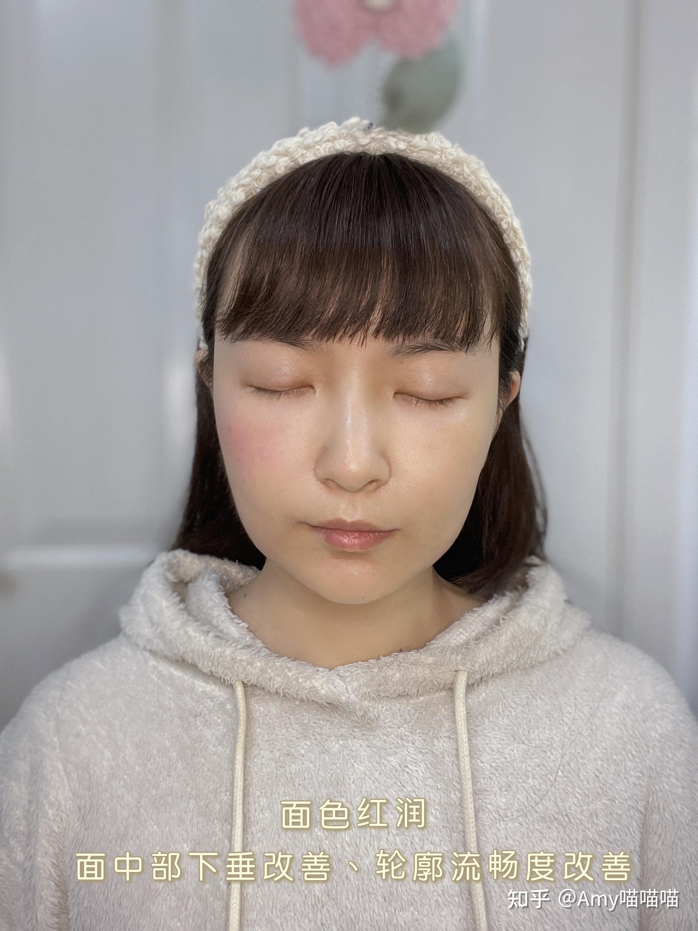 ellkii idun驻颜仪使用测评