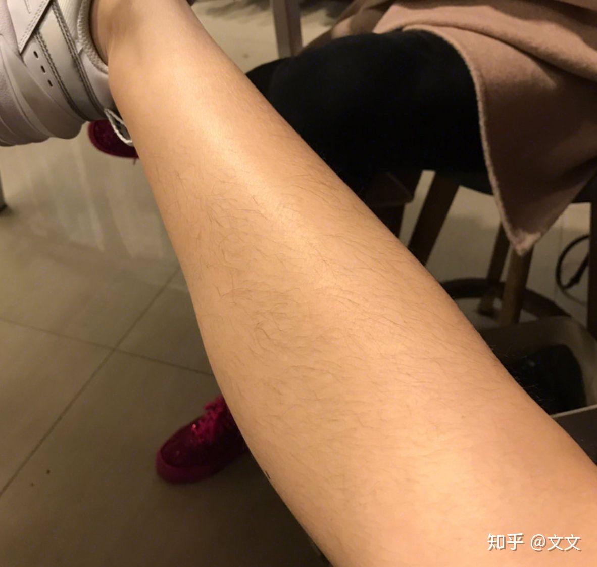 女生因为腿毛多活得很压抑怎么办? - 知乎