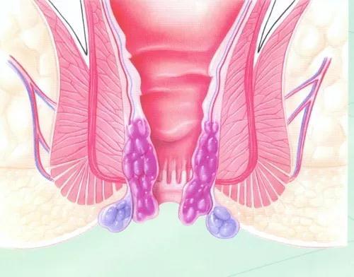 v2-0670356a88b00783861b487580761c33_1440w.jpg?source=172ae18b