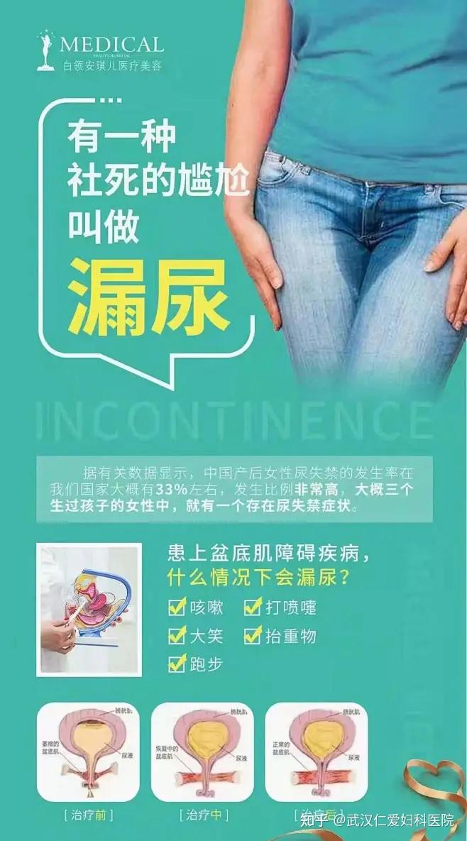 女性【尿失禁】的源头，你可知多少？ - 知乎
