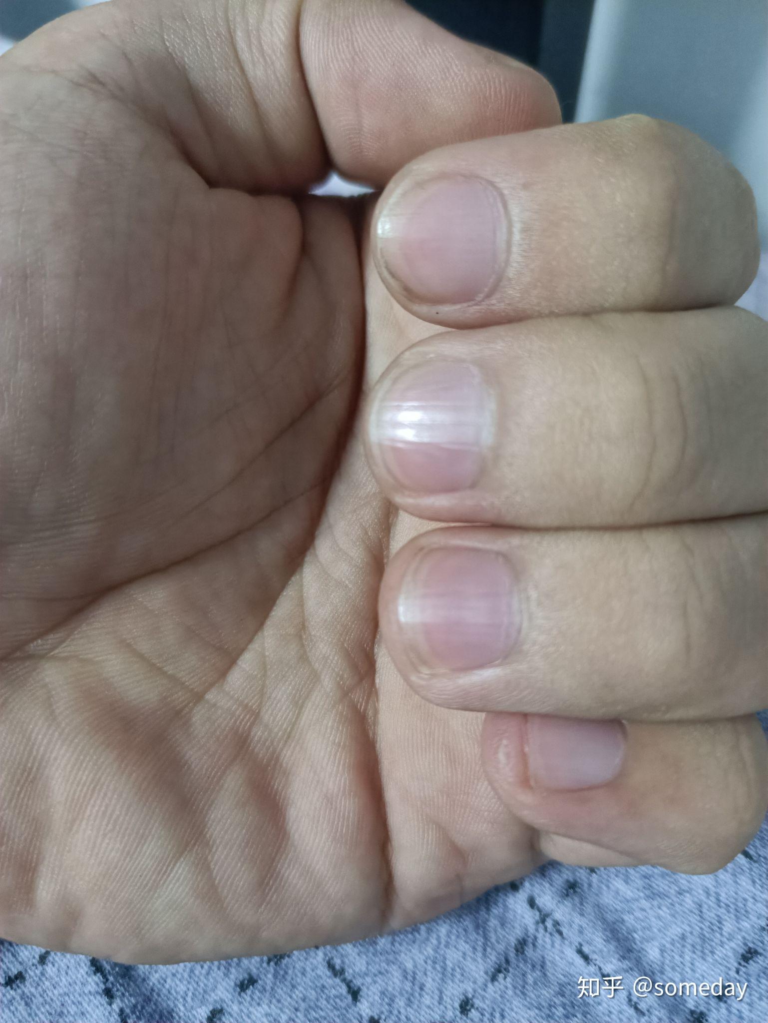 我是那种手指头很粗  指尖很厚很肉的那种  玩吉他是不是没条件啊?