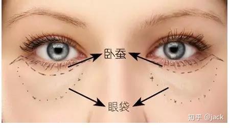 卧蚕眼是什么意思 v2-06ce855f0ef4ffc8def40f78d72cbfe4_r.jpg