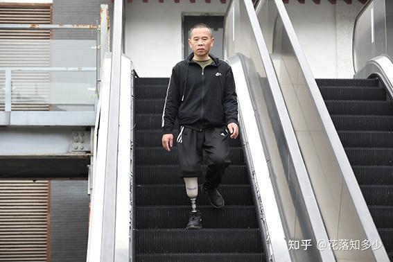 严重冻伤可能会导致截肢 - 知乎