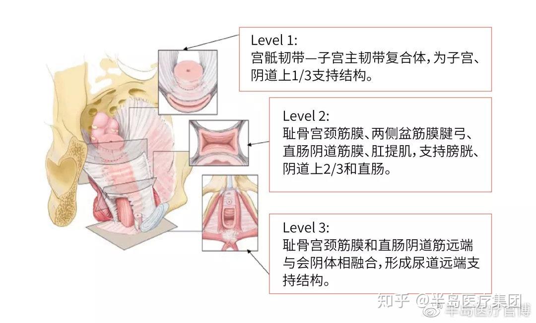 拿上瓜子我们今天来细说争论了一个世纪之久的盆底理论