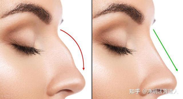 面相学入门知识大全之鼻相图文详解大全 - 知乎