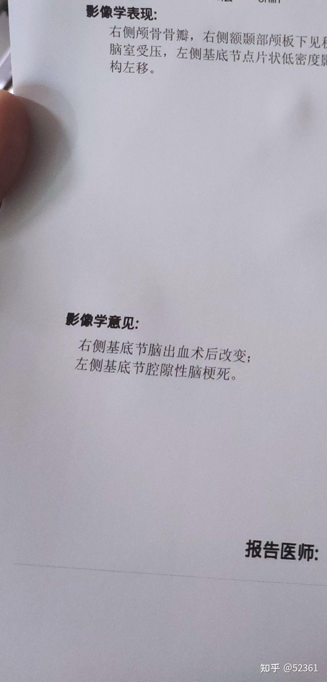 右半身可以正常活動,檢查是右腦右側基底節區出血大概20,當時意識還算