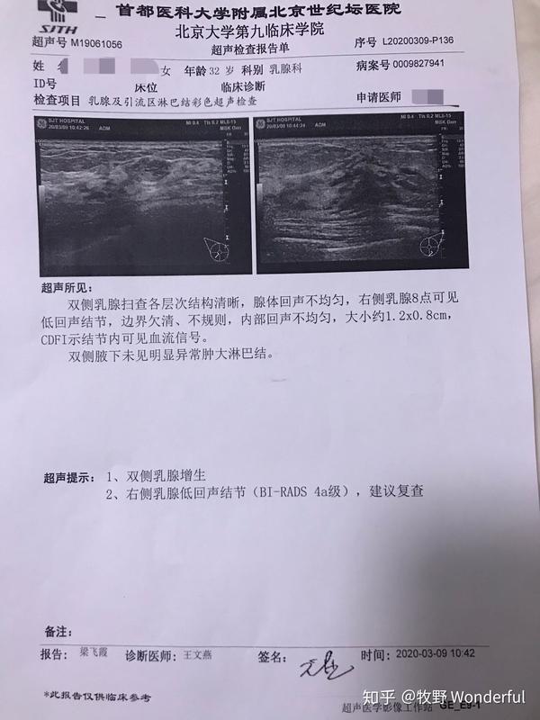 乳腺結節4a感恩