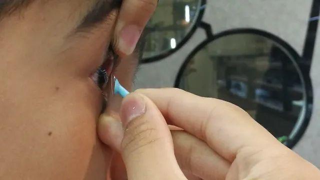 的孩子使用一种被称为"ok镜"的近视防控产品,以帮助他们矫正视力问题