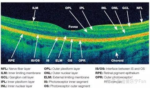 眼科利器oct的原理浅析