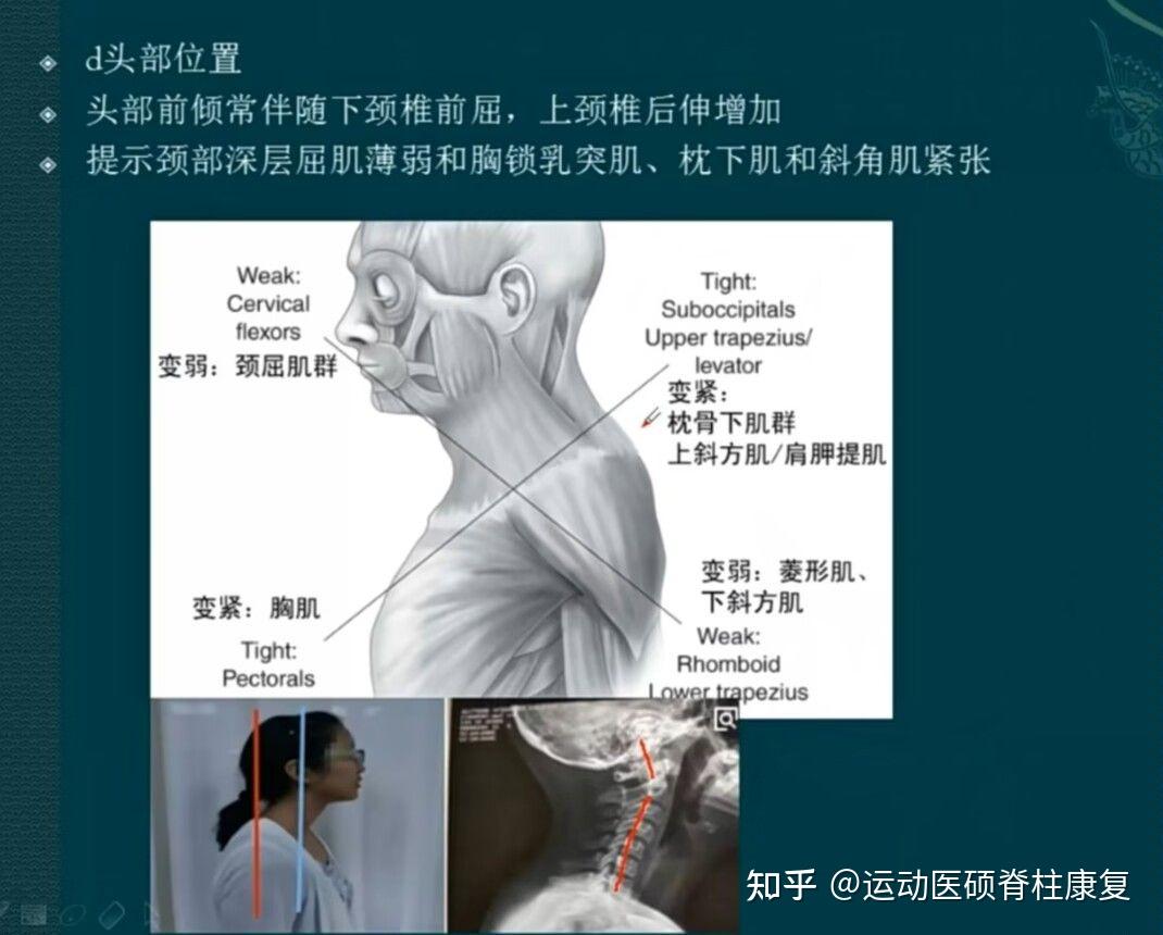 头颈部动静态异常分析6 - 知乎