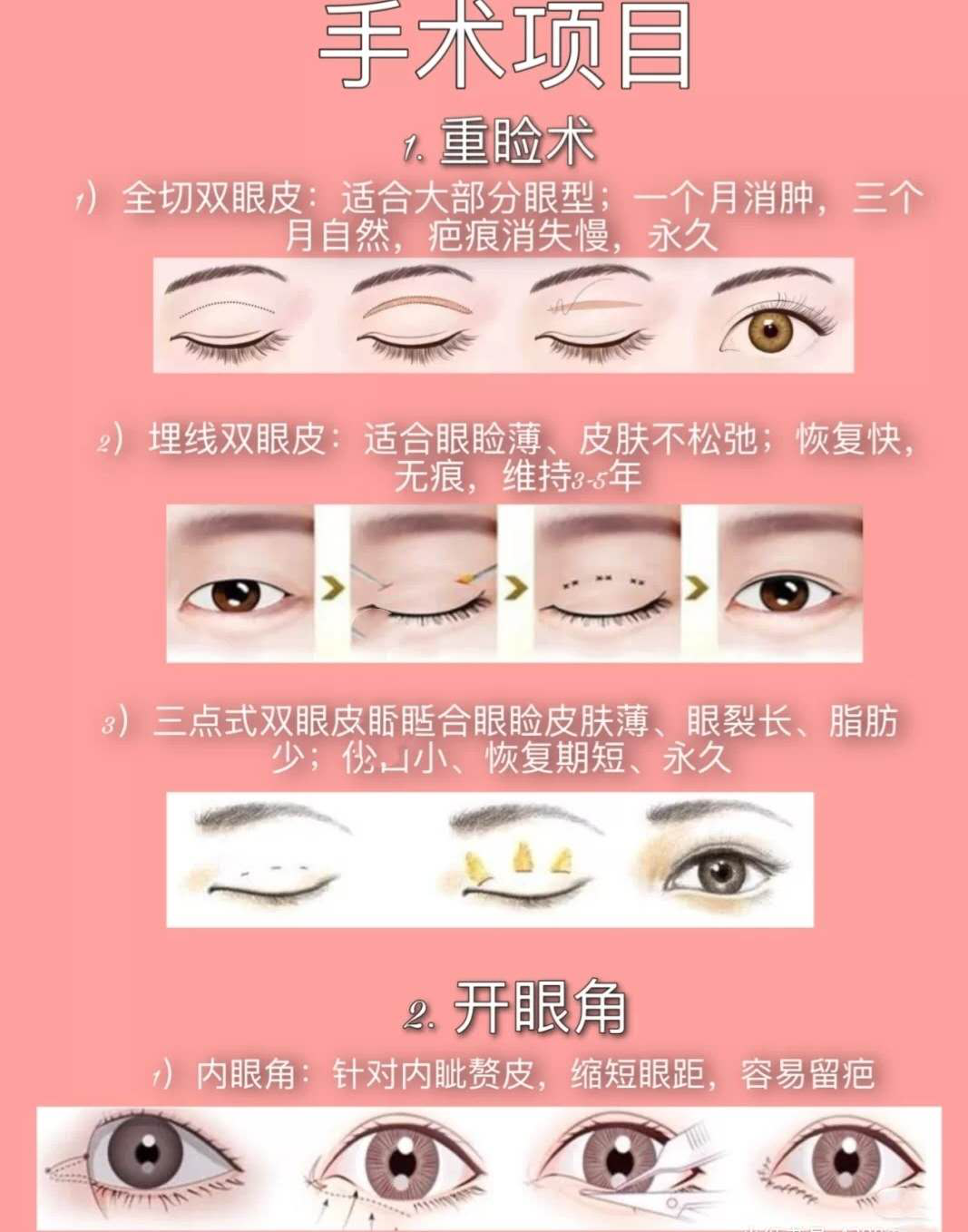 小突眼为什么双眼皮弧度短而圆 - 周兆平整形网