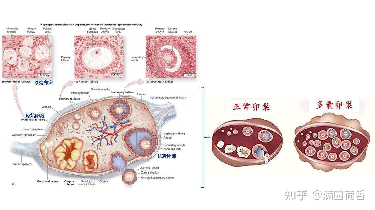 摘自《多囊卵巢综合征病因与发病机制的研究进展,吉林大学第一医院