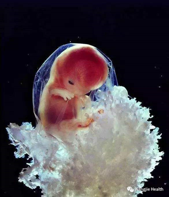 二个月胎儿图什么样子图片