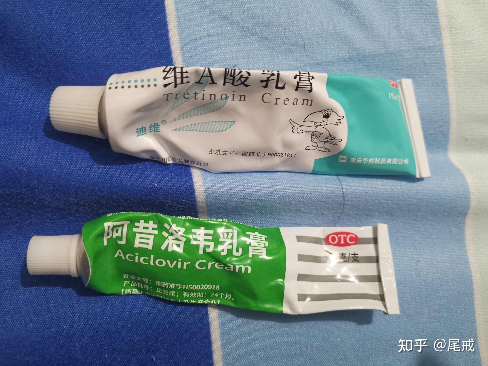 跖疣的治疗过程