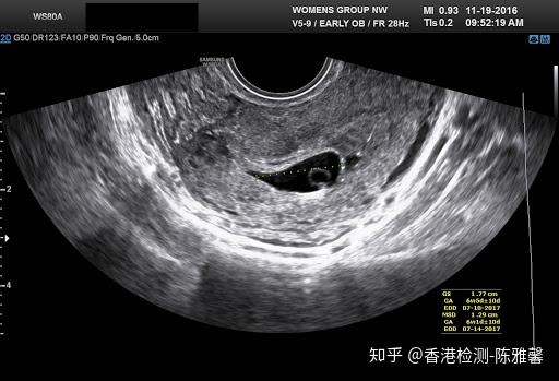 怀孕 生男还是生女 传说中的 土 方法全是坑 知乎