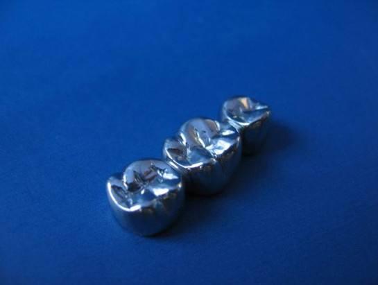 口腔科普铁齿铜牙vs唇红齿白如何选择牙冠修复材料一篇文章教你全方位