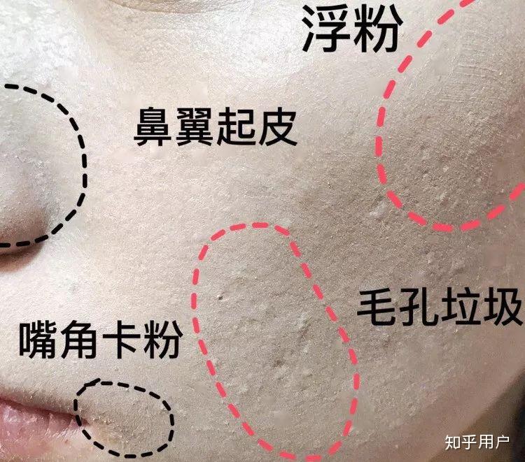 粉底浮粉卡粉还有皮肤有干纹具体是什么样子的