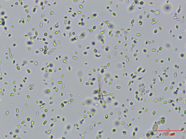 酵母菌图 显微镜图片