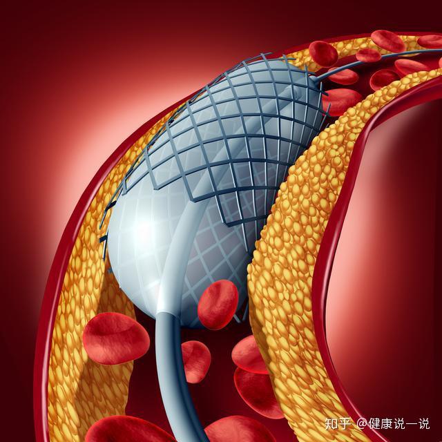 v2-093550e7b18421cea0e0c0f62bc99c98_r.jpg