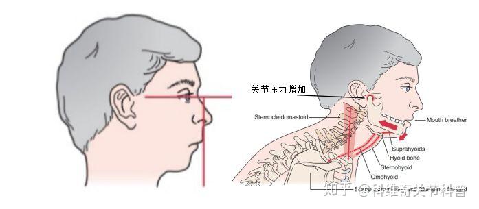 顳下頜關節紊亂患者的自我健康管理