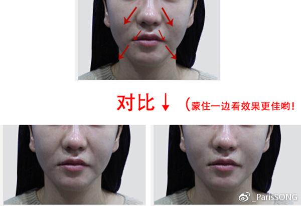 正名:木偶纹&法令纹对苦相感的加成>嘴角下垂