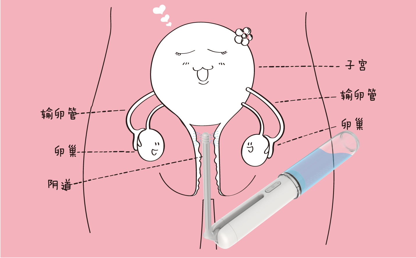 妇科冲洗器怎么用？ - 知乎