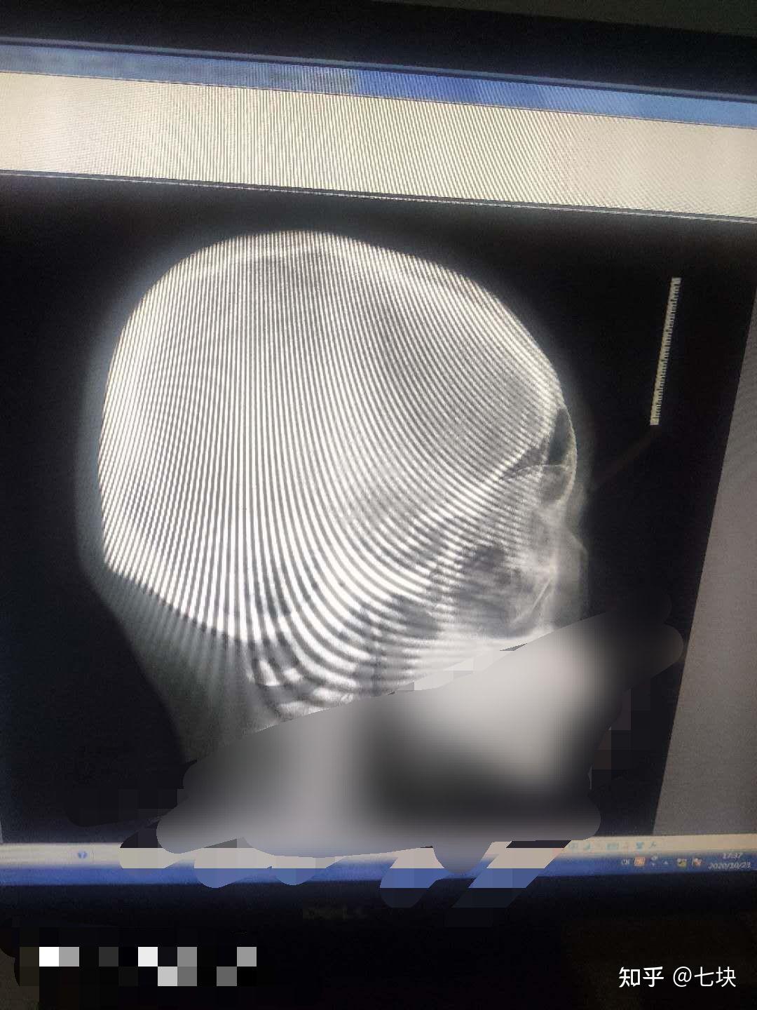 圆头扁头怎么区分