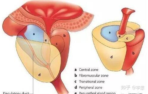 父亲在六年前检查出前列腺癌早期现在复发怎么办