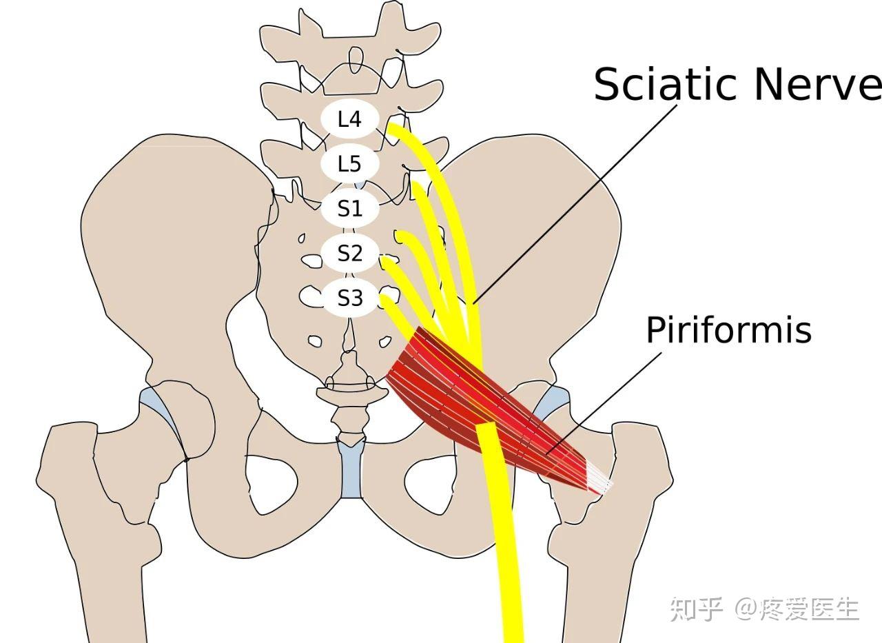这块肌肉从坐骨大孔穿出骨盆,止于股骨大转子的顶部,它的下方会经过一