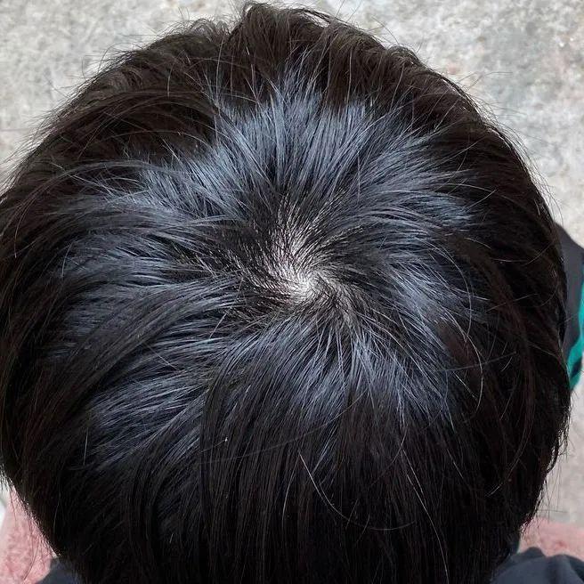 北半球的人头发旋儿顺时针？南半球逆时针？ - 知乎
