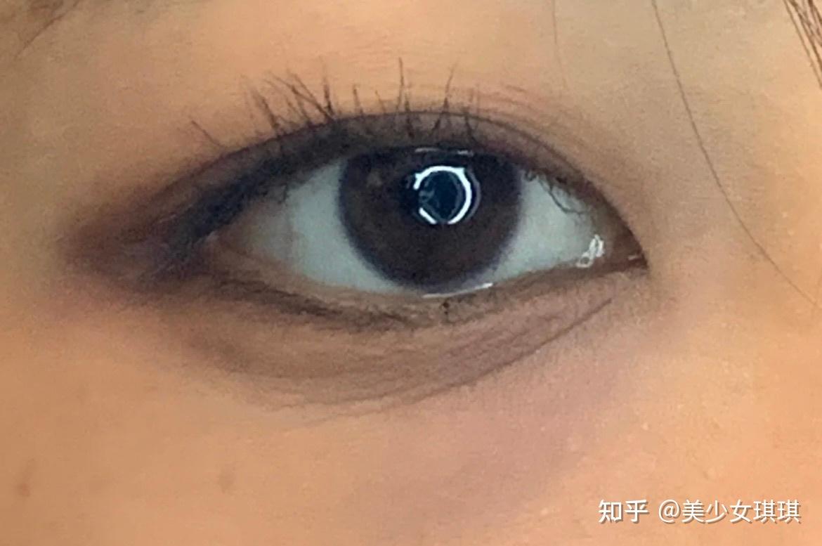 22岁眼下细纹好严重求推荐眼霜