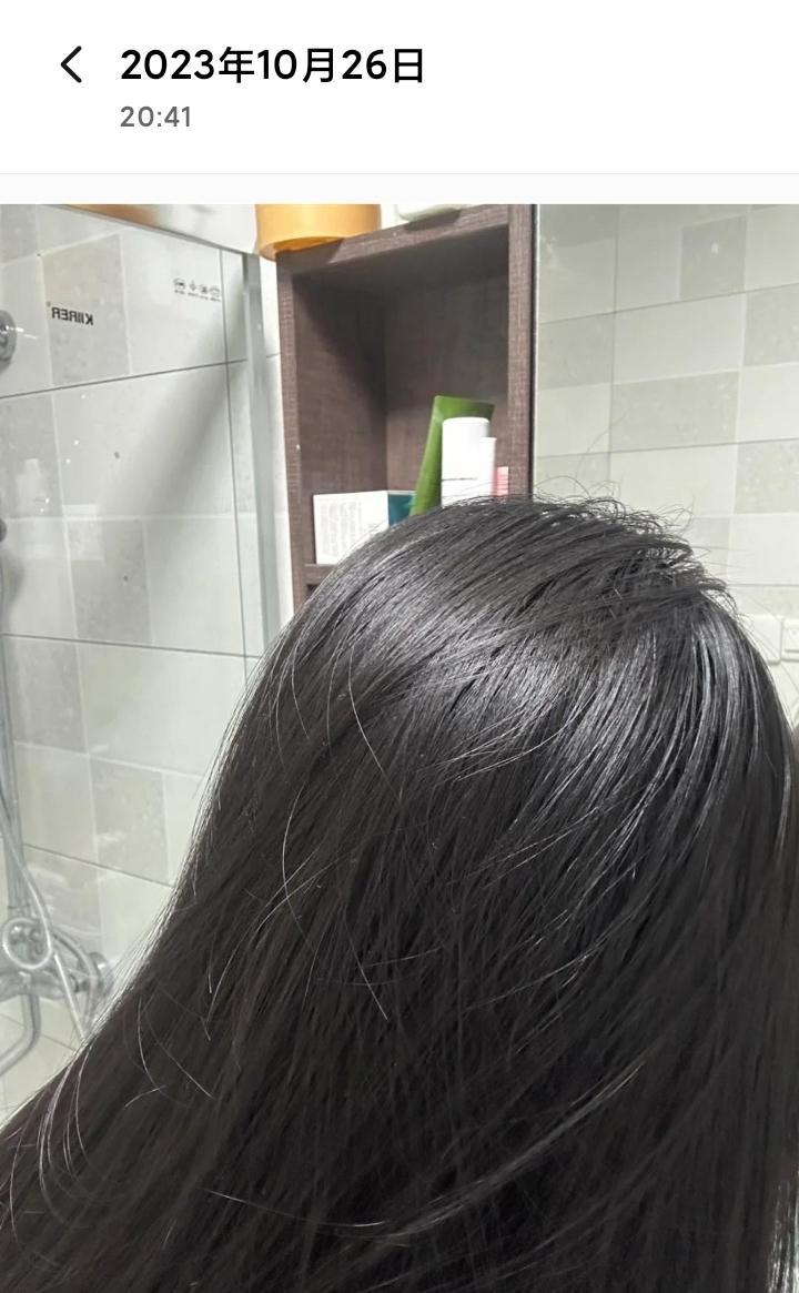 为什么头发总是很油