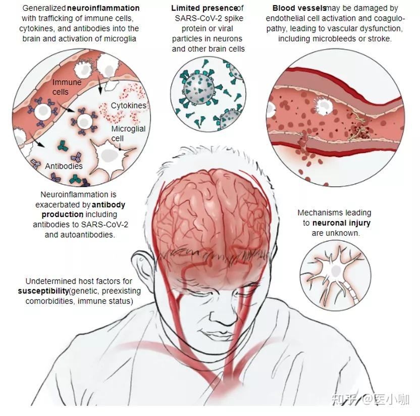 血脑屏障 新冠图片