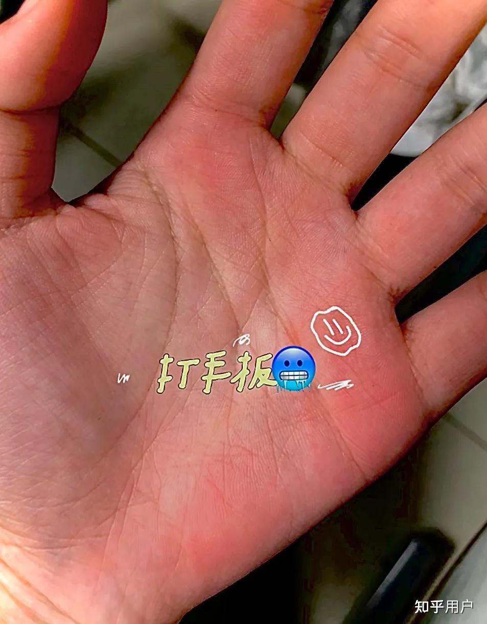 有没有被老师打手心的经历?