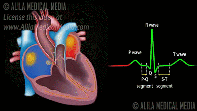 心脏传导动图图片