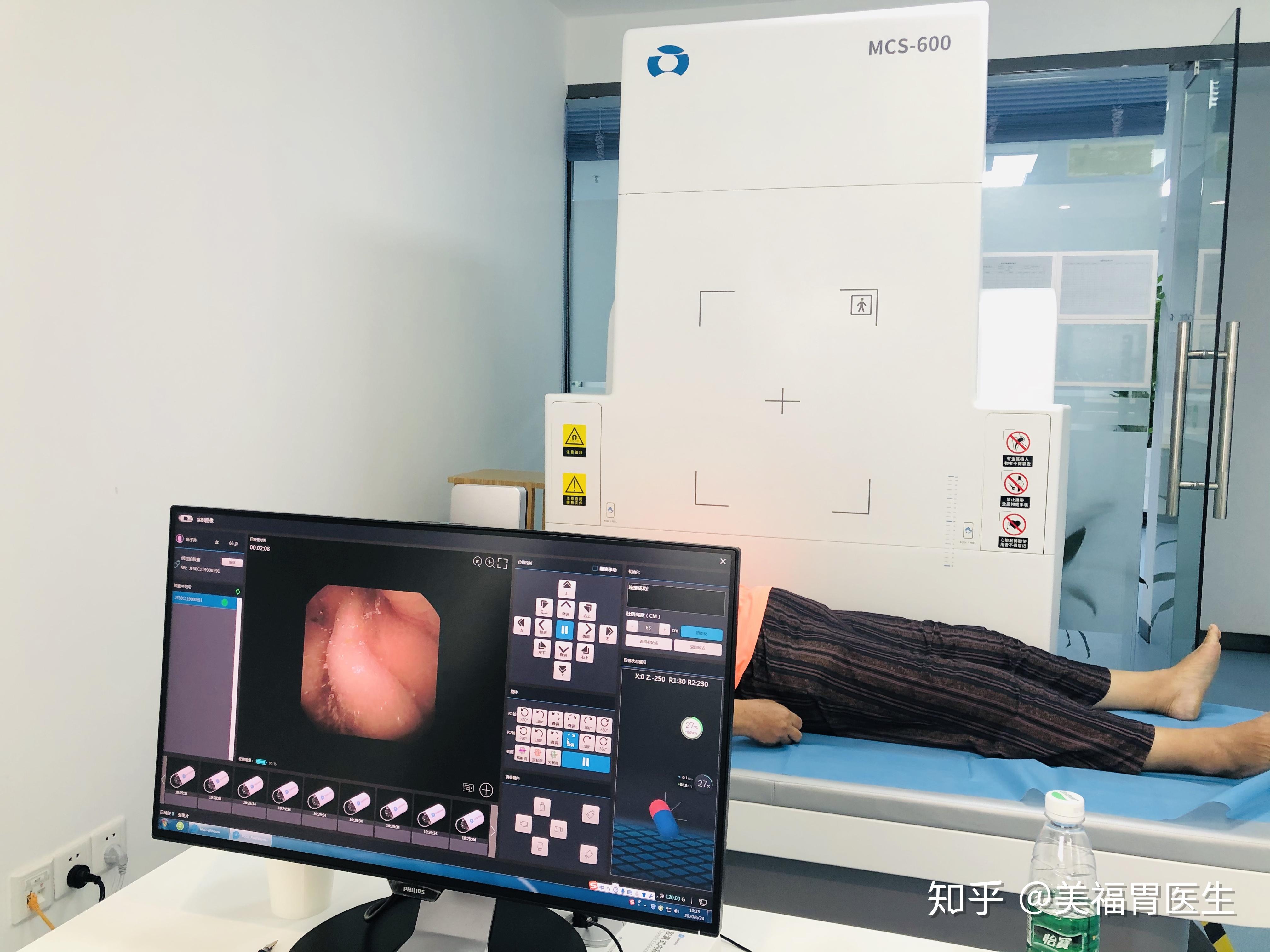 胃镜检查,是需要下管的,利用一条直径约一公分的黑色塑胶包裹导光纤维