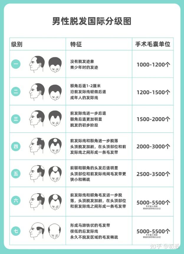 植发最全攻略||到底靠谱吗?价格多少钱?真的很贵吗?植发技术有哪些? - 知乎