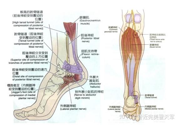 足跟足心痛筋膜肌肉还是神经